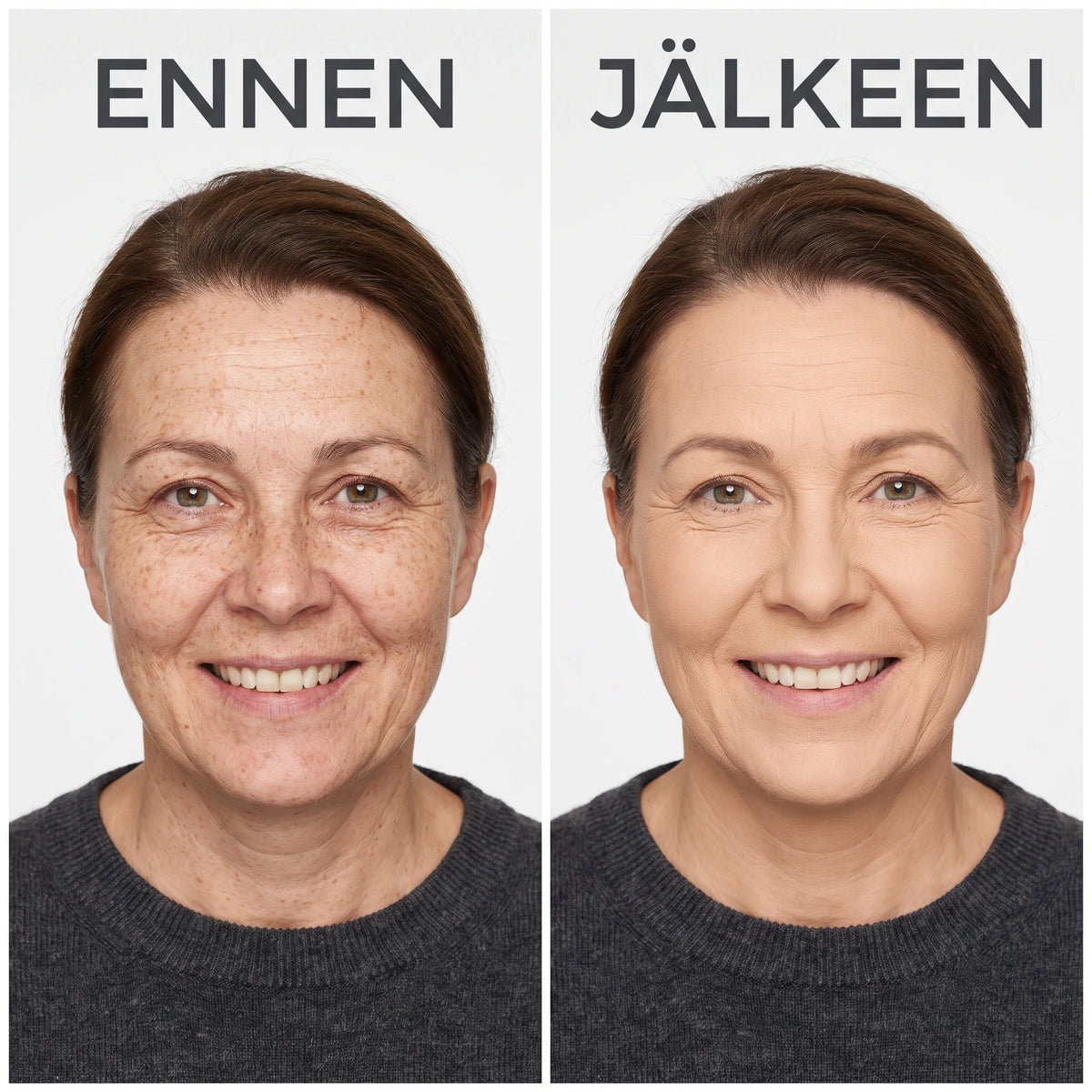 Ennen ja jälkeen, peitetty punoitus
